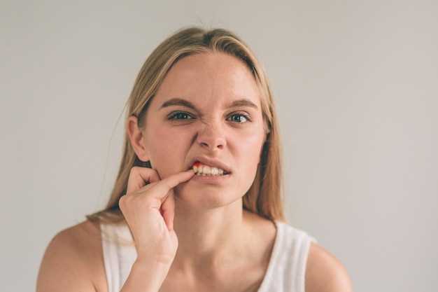 Как снюс влияет на здоровье десен и зубов?