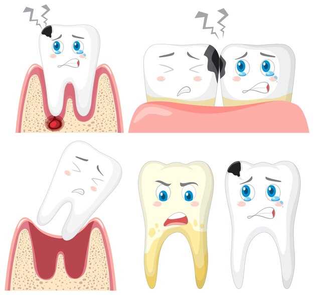 Как снюс влияет на зубы: причины и способы укрепления