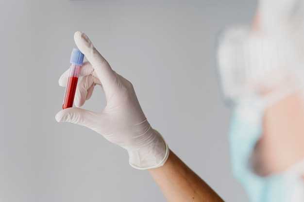 Мочевина в анализе крови: значение и норма