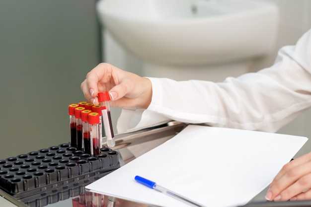 Как проходит анализ на ВИЧ в лаборатории