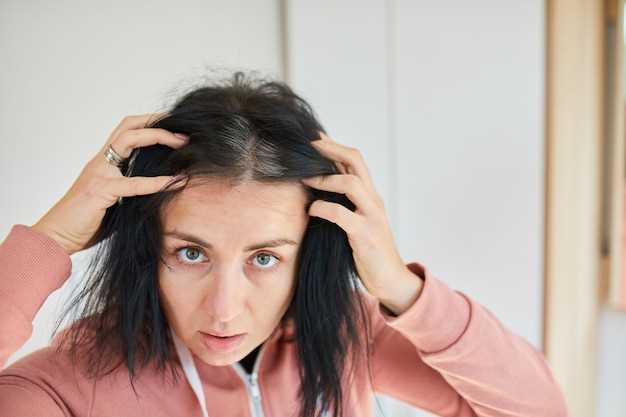 Почему выпадают волосы на голове у женщин?